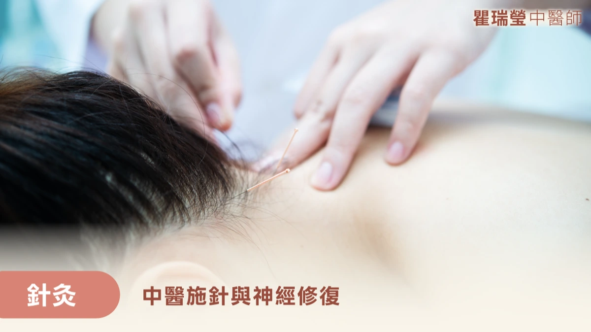 針灸