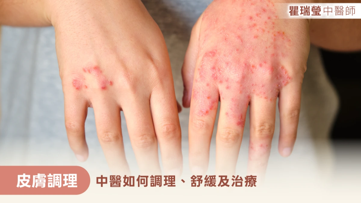 皮膚調理